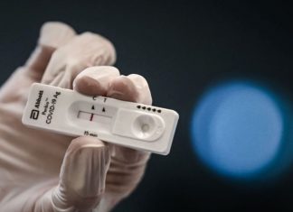 2 φορές τον μήνα rapid tests θα μπορούν να κάνουν οι εργαζόμενοι