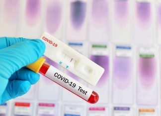 Διενέργεια δωρεάν rapid tests στο Δήμο Ελευσίνας